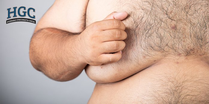 Causes of Gynecomastia